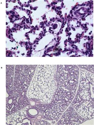 An Unsettled Promise: The Newborn Piglet Model of Neonatal Acute Respiratory Distress Syndrome (NARDS). Physiologic Data and Systematic Review